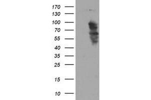 Western Blotting (WB) image for anti-SRY (Sex Determining Region Y)-Box 5 (SOX5) antibody (ABIN1501082) (SOX5 抗体)