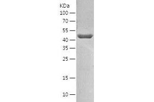 Western Blotting (WB) image for Cytohesin 2 (CYTH2) (AA 1-399) protein (His tag) (ABIN7122587) (Cytohesin 2 Protein (CYTH2) (AA 1-399) (His tag))