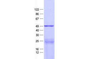 Western Blotting (WB) image for Protein Phosphatase 1, Regulatory Subunit 36 (PPP1R36) protein (His tag) (ABIN2714065)