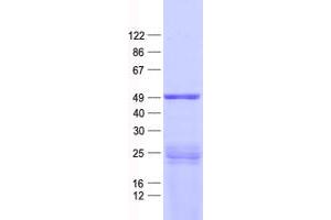 PPP1R36 Protein (His tag)