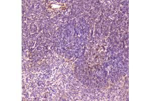 IHC analysis of CD163 using anti-CD163 antibody . (CD163 抗体  (AA 47-201))