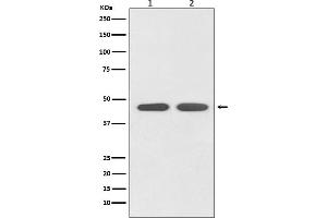 Western blot analysis of AGTR1 expression in (1) HeLa cell lysate, (2) PC-12 cell lysate.
