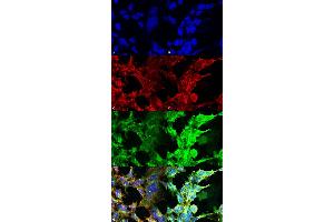 Immunocytochemistry/Immunofluorescence analysis using Mouse Anti-Methylglyoxal Monoclonal Antibody, Clone 9F11 . (Methylglyoxal (MG) 抗体 (Biotin))