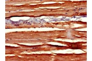 Immunohistochemistry of paraffin-embedded human skeletal muscle tissue using ABIN7169811 at dilution of 1:100 (SLIT3 抗体  (AA 1199-1494))