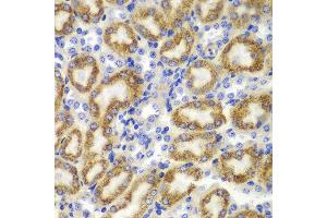 Immunohistochemistry of paraffin-embedded mouse kidney using TNFSF11 antibody at dilution of 1:100 (400x lens). (RANKL 抗体)