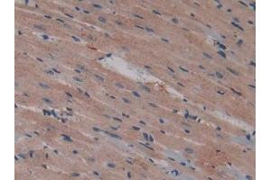 DAB staining on IHC-P; Samples: Mouse Heart Tissue (Talin 抗体  (AA 975-1181))