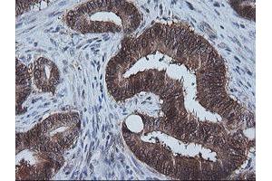 Image no. 1 for anti-Cytidine Monophosphate (UMP-CMP) Kinase 1, Cytosolic (CMPK1) antibody (ABIN1497541) (Cytidine Monophosphate (UMP-CMP) Kinase 1, Cytosolic (CMPK1) 抗体)