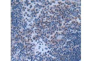 IHC-P analysis of Human Tissue, with DAB staining. (IRF5 抗体  (AA 136-475))