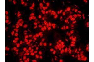 Immunofluorescence (IF) image for anti-Nucleophosmin (Nucleolar phosphoprotein B23, Numatrin) (NPM1) (AA 250-294) antibody (ABIN7448992) (NPM1 抗体  (AA 250-294))