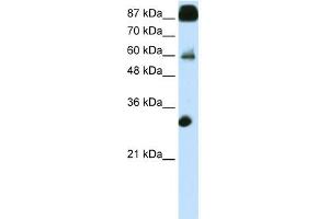 WB Suggested Anti-CTCF Antibody Titration:  0. (CTCF 抗体  (N-Term))