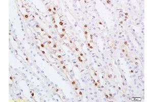 Formalin-fixed and paraffin embedded rat kidney tissue labeled with Anti ZHX2/Alpha fetoprotein regulator 1 Polyclonal Antibody, Unconjugated  at 1:100 followed by conjugation to the secondary antibody and DAB staining (ZHX2 抗体  (AA 451-550))