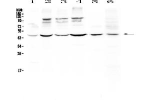 Western blot analysis of DC-SIGN using anti-DC-SIGN antibody . (DC-SIGN/CD209 抗体)