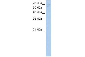 WB Suggested Anti-CACNB2 Antibody Titration:  2. (CACNB2 抗体  (Middle Region))
