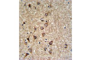 Immunohistochemistry (Paraffin-embedded Sections) (IHC (p)) image for anti-Solute Carrier Family 25, Member 37 (SLC25A37) (AA 309-338), (C-Term) antibody (ABIN653670)