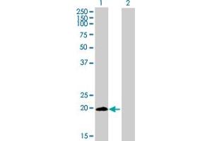 Western Blot analysis of LYPD5 expression in transfected 293T cell line by LYPD5 MaxPab polyclonal antibody. (LYPD5 抗体  (AA 1-208))