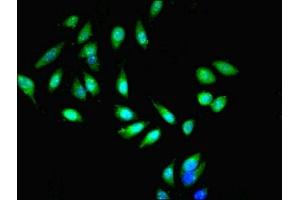 Immunofluorescent analysis of Hela cells cells using ABIN7151063 at dilution of 1:100 and Alexa Fluor 488-congugated AffiniPure Goat Anti-Rabbit IgG(H+L) (MIB1 抗体  (AA 5-332))