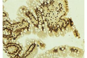 ABIN6277656 at 1/100 staining Mouse colon tissue by IHC-P.
