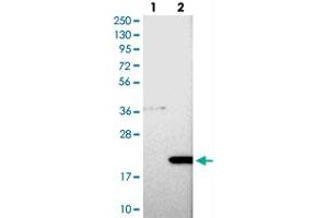 Western blot analysis of Lane 1: Negative control (vector only transfected HEK293T lysate), Lane 2: Over-expression Lysate (Co-expressed with a C-terminal myc-DDK tag (~3. (COMMD8 抗体)