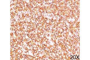 IHC testing of human tonsil (20X) stained with PD7/26 mAb. (CD45RB 抗体)