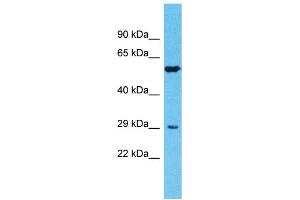 Host: Rabbit Target Name: TMPRSS11E Sample Type: Fetal Lung lysates Antibody Dilution: 1. (TMPRSS11E 抗体  (N-Term))