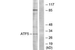 Western blot analysis of extracts from Jurkat cells, using ATF5 Antibody. (ATF5 抗体  (AA 221-270))