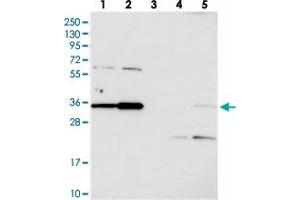 Western blot analysis of Lane 1: RT-4, Lane 2: U-251 MG, Lane 3: Human Plasma, Lane 4: Liver, Lane 5: Tonsil with C3orf26 polyclonal antibody  at 1:250-1:500 dilution. (CMSS1 抗体)