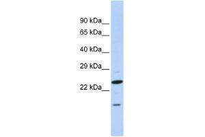 INSIG2 antibody used at 1 ug/ml to detect target protein. (INSIG2 抗体  (N-Term))