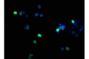 Immunofluorescence staining of HepG2 cells with ABIN7139617 at 1:100, counter-stained with DAPI. (Histone H1.5 抗体  (pSer17))