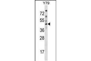 Western blot analysis in Y79 cell line lysates (35ug/lane). (Dematin 抗体  (AA 249-277))