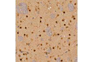 Immunohistochemistry (IHC) image for anti-Calcium/calmodulin-Dependent Protein Kinase IV (CAMK4) (AA 304-473) antibody (ABIN6137891)