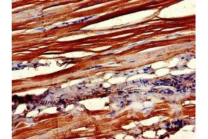 Immunohistochemistry (IHC) image for anti-Ciliary Neurotrophic Factor Receptor (CNTFR) (AA 106-342) antibody (ABIN7147780)