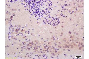 Formalin-fixed and paraffin embedded rat brain labeled with Rabbit Anti Thyroid peroxidase Polyclonal Antibody, Unconjugated (ABIN1713917) at 1:200 followed by conjugation to the secondary antibody and DAB staining (Thyroperoxidase 抗体  (AA 111-210))