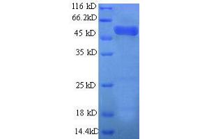 SDS-PAGE (SDS) image for Actin Related Protein 2/3 Complex, Subunit 2, 34kDa (ARPC2) (AA 1-250), (partial) protein (GST tag) (ABIN7479280)