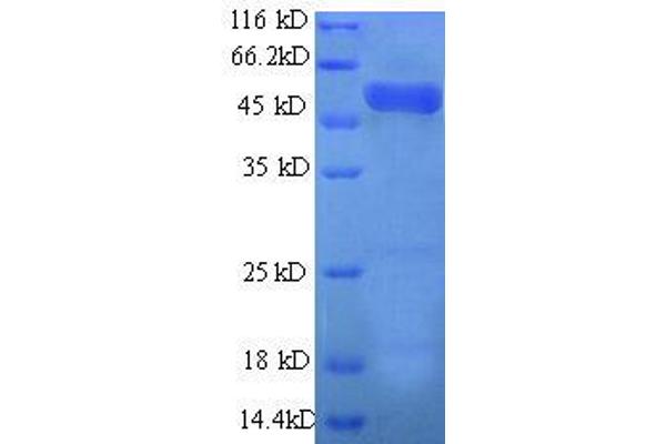 ARPC2 Protein (AA 1-250, partial) (GST tag)
