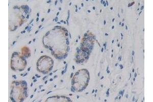 Immunohistochemistry (IHC) image for anti-Doublecortin-Like Kinase 1 (DCLK1) (AA 390-647) antibody (ABIN7436015)