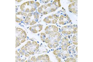 Immunohistochemistry of paraffin-embedded human stomach using TNFRSF10A antibody (ABIN5973697) at dilution of 1/100 (40x lens). (TNFRSF10A 抗体)