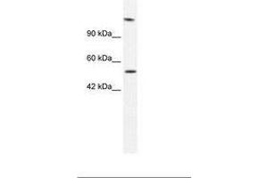 Image no. 1 for anti-DNA Helicase B (HELB) (AA 77-126) antibody (ABIN202971) (DNA Helicase B 抗体  (AA 77-126))