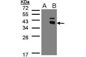 WB Image Western Blot analysis of PPM1K expression in transfected 293T cell line by PPM1K polyclonal antibody. (PPM1K 抗体)