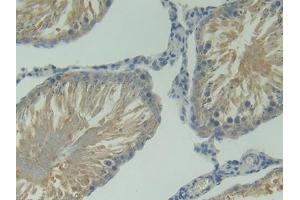 DAB staining on IHC-P; Samples: Rat Testis Tissue (TNFRSF13C 抗体  (AA 45-169))