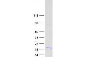Western Blotting (WB) image for Myelin Basic Protein (MBP) (Transcript Variant 4) protein (Myc-DYKDDDDK Tag) (ABIN2726640)