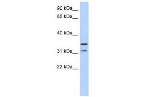 Western Blotting (WB) image for anti-Retinoic Acid Induced 12 (RAI12) antibody (ABIN2459706) (Retinoic Acid Induced 12 (RAI12) 抗体)