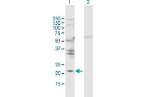 Western Blot analysis of TIMP2 expression in transfected 293T cell line by TIMP2 MaxPab polyclonal antibody. (TIMP2 抗体  (AA 1-220))