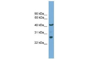 TMEM176A antibody used at 0. (TMEM176A 抗体  (N-Term))