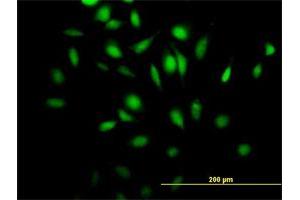 Immunofluorescence of purified MaxPab antibody to Rgr on HeLa cell. (RGL4 抗体  (AA 1-410))
