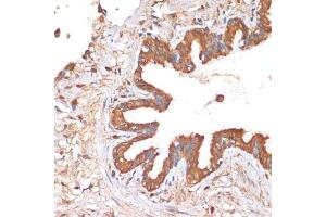Immunohistochemistry of paraffin-embedded human lung using HHL antibody (ABIN6132190, ABIN6141750, ABIN6141751 and ABIN6217197) at dilution of 1:100 (40x lens). (HHLA2 抗体  (AA 30-200))