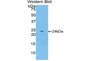 Western Blotting (WB) image for anti-Pentraxin 3 (PTX3) (AA 195-381) antibody (ABIN1860373) (PTX3 抗体  (AA 195-381))