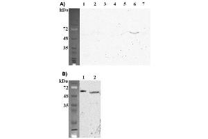 Western blot analysis using anti-FTO (mouse), mAb (FT62-6)  at 1:2'000 dilution. (FTO 抗体)