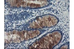 Image no. 3 for anti-F-Box Protein 42 (FBXO42) (AA 356-717) antibody (ABIN1491450) (FBXO42 抗体  (AA 356-717))