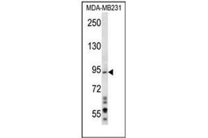 Western blot analysis of MAD1L1 Antibody (N-term) in MDA-MB231 cell line lysates (35ug/lane). (MAD1L1 抗体  (N-Term))