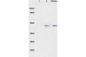 L1 rat brain lysates L2 rat heart lysates probed with Anti NK-2R/Neurokinin A Polyclonal Antibody, Unconjugated (ABIN725315) at 1:200 overnight at 4 °C. (TACR2 抗体  (AA 223-300))